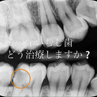 画像462