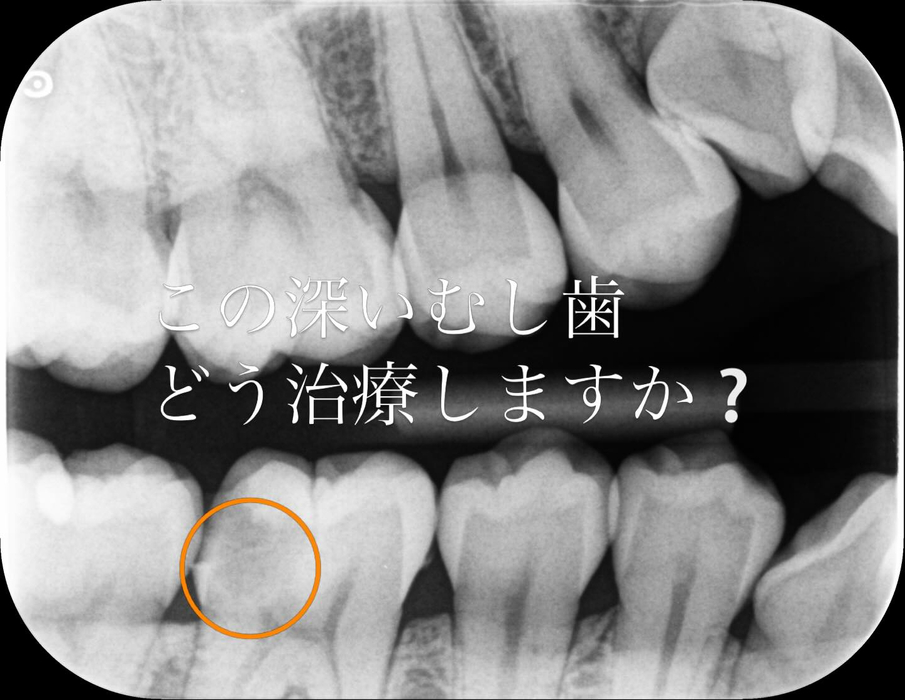 画像462